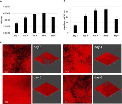 Unique Features of Mycobacterium abscessus Biofilms Formed in Synthetic Cystic Fibrosis Medium